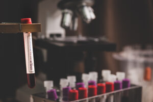 Bloodwork