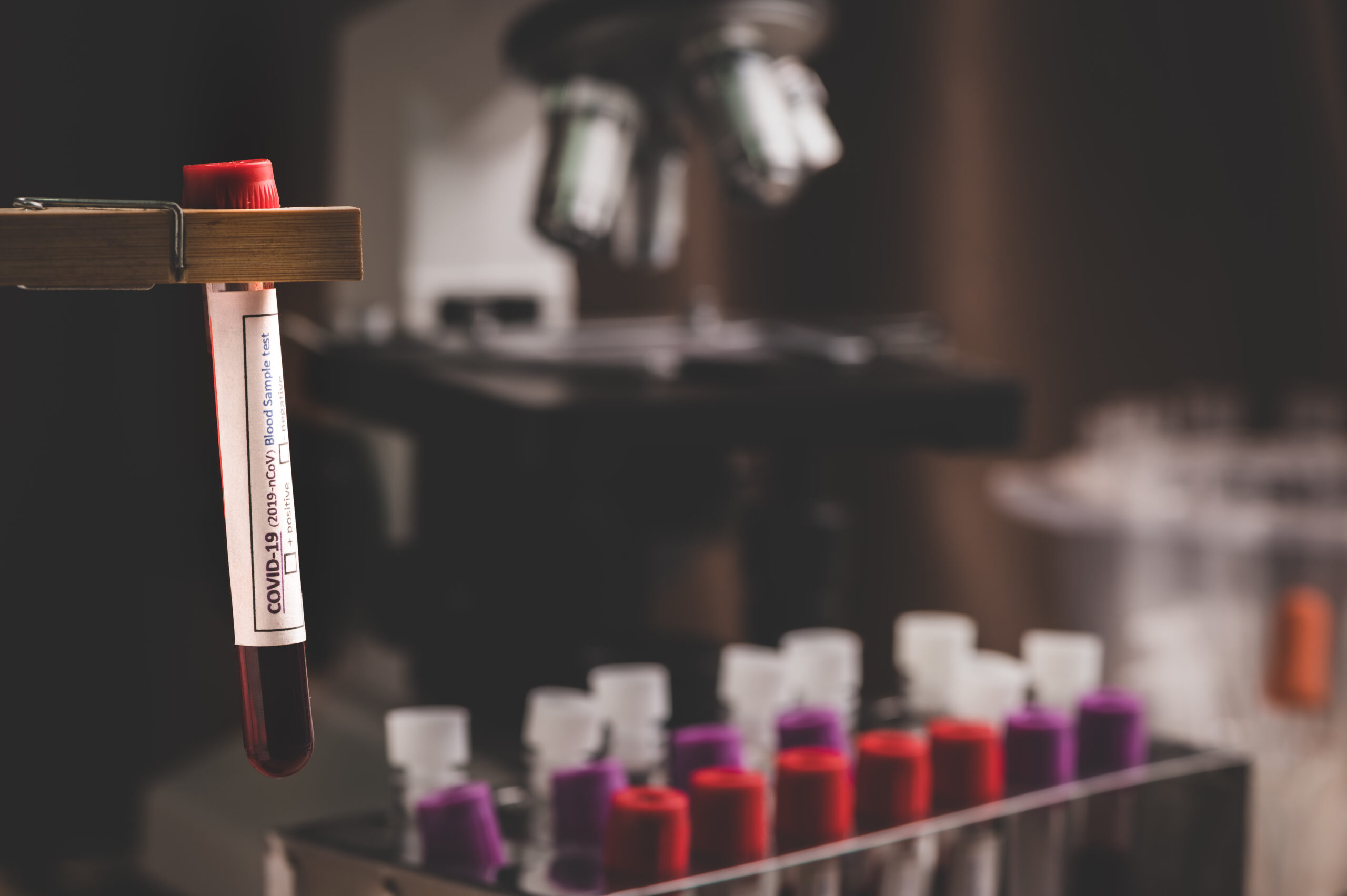 You are currently viewing What Your Annual Bloodwork Can Reveal About Your Health